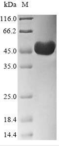 (Tris-Glycine gel) Discontinuous SDS-PAGE (reduced) with 5% enrichment gel and 15% separation gel.